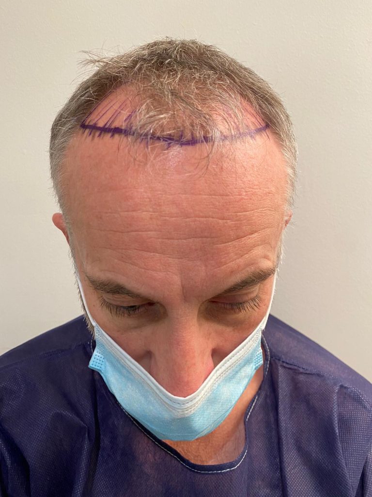 Pre-treatment evaluation